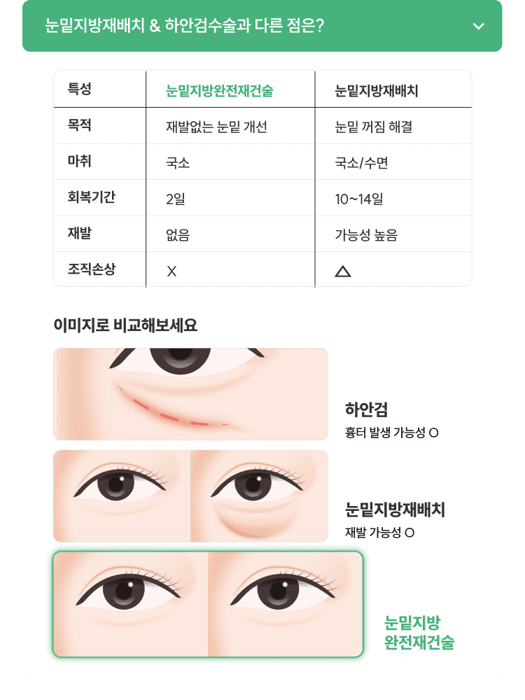 눈밑지방재배치청담EL