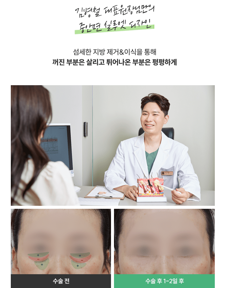 눈밑지방재배치청담EL
